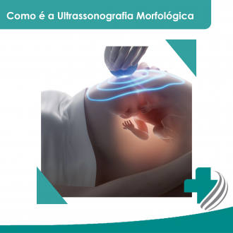 Ultrassonografia Morfologica de Segundo Trimestre em São Paulo