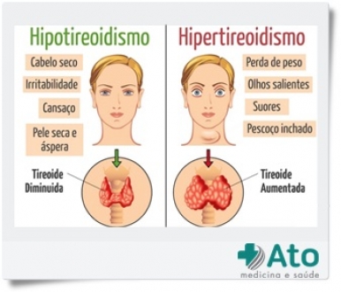 Hipotireoidismo ou Hipertireoidismo