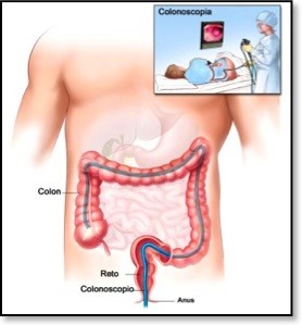 Colonoscopia-ato