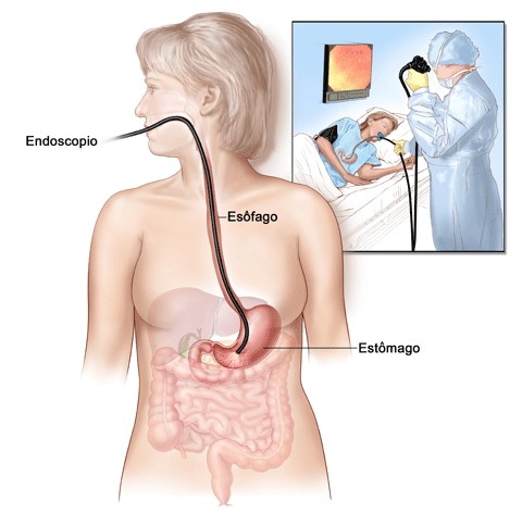 Endostar - Exames endoscópicos de alta complexidade