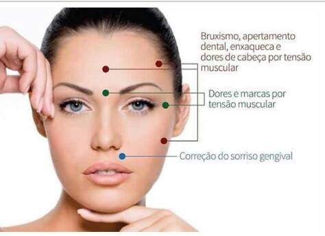 Botox-terapeutico